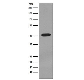 Western blot testing of human T-47D cell lysate with Cytokeratin 7 antibody. Predicted molecular wei