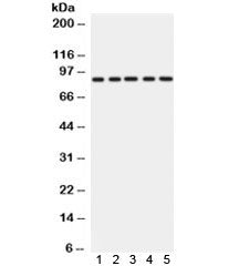 Western blot testing of 1) rat liver, 2) rat heart, 3) mouse liver, 4) mouse heart and 5) human SMCC