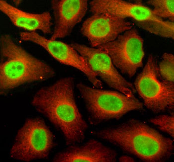 Immunofluorescent staining of SUPT16H using anti-SUPT16H antibody (green) and anti-Beta Tubulin anti