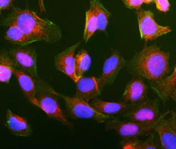 Immunofluorescent staining of GIPC1 using anti-GIPC1 antibody (red). GIPC1 was detected in an immuno