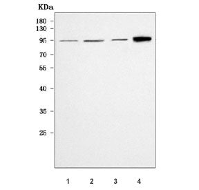 PKP2 Antibody / Plakophilin 2