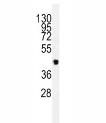 Western blot analysis of lysate from 293 cells using VEGFC antibody. Predicted molecular weight ~45 