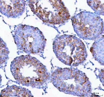 IHC staining of FFPE rat testis tissue with Epigen antibody. HIER: boil tissue sections in pH8 EDTA 