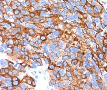 MART-1 / Melan-A Antibody Cocktail