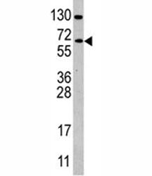 Western blot analysis of CDC25B antibody and Ramos lysate. Expected/observed molecular weight: 61~67