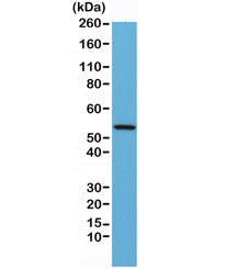 Western blot testing of mouse heart lysate with recombinant Desmin antibody at 1:1000. Predicted mol
