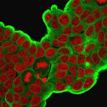 Immunofluorescent staining of PFA-fixed human MCF7 cells with HSP27 antibody (clone HSPB1/774, green