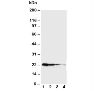 Western blot testing of Growth Hormone antibody and Lane 1: Recombinant mouse GH protein 10ng; 2: 5n