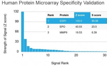 Estrogen Receptor alpha Antibody