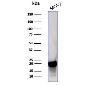 NME2 Antibody / Nucleoside diphosphate kinase B / NDKB