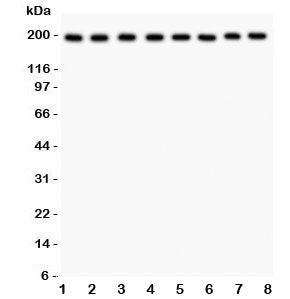 Western blot testing of ZO-1 antibody and Lane 1: rat liver; 2: mouse liver; 3: (r) NRK; 4: (r) PC12