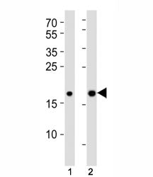 Hmga2 Antibody