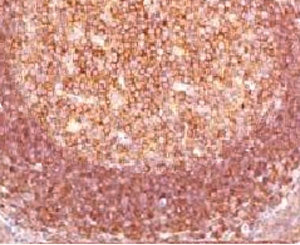 IHC staining of human tonsil with Bcl10 antibody (clone MUBC10). Required HIER: boil tissue sections