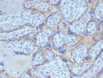IHC staining of FFPE human placental tissue with recombinant EGF Receptor antibody (clone rEGFR/6389). HIER: boil tissue sections in pH 9 10mM Tris with 1mM EDTA for 20 min and allow to cool before testing.