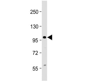 Western blot testing of human Jurkat cell lysate with CIP2A antibody at 1:2000. Predicted molecular 
