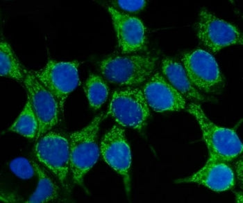 Immunofluorescent staining of FFPE human MCF7 cells with HSP70 antibody (green) and DAPI nuclear sta