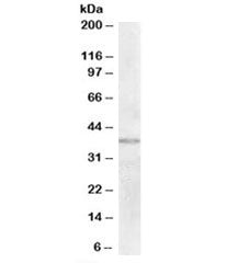 Western blot testing of human uterus lysate with TXNDC6 antibody at 2ug/ml. Predicted molecular weig