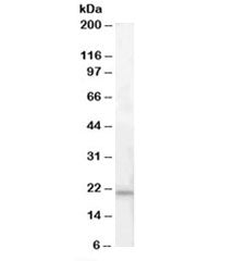 Western blot testing of human pancreas lysate with ARMET antibody at 0.3ug/ml. Predicted molecular w