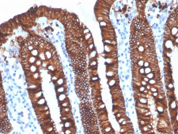 EpCAM Antibody