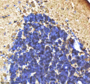IHC staining of zebrafish Il-1 beta protein using Zebrafish Il-1 beta antibody, HRP-labeled secondar