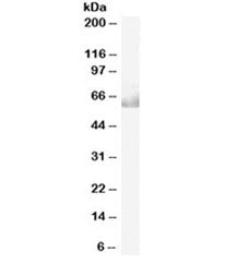 Western blot testing of human ovay lysate with CDT1 antibody at 0.05ug/ml. Predicted molecular weigh