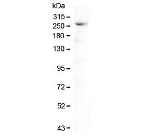 Western blot testing of mouse pancreas lysate with CAD antibody at 0.5ug/ml. Predicted molecular wei