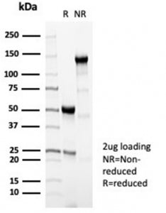 Perforin Antibody / PRF1
