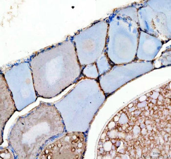 IHC staining of zebrafish Kita protein using Zebrafish Kita antibody, HRP-labeled secondary and DAB 