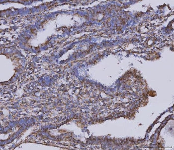 Malate dehydrogenase 2 Antibody / MDH2