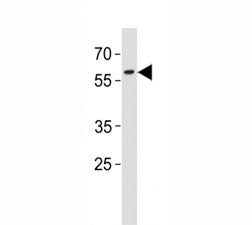PAX3 antibody western blot analysis in A431 lysate. Predicted molecular weight: there are 7 isoforms