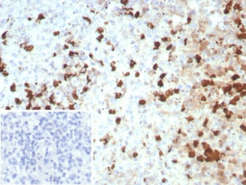 IHC staining of FFPE human spleen tissue with CGRP antibody (clone S100A12/8952R). Inset: PBS used i