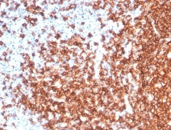 IHC staining of FFPE human tonsil tissue with recombinant CD20 antibody (clone MS4A1/7015R). HIER: boil tissue sections in pH 9 10mM Tris with 1mM EDTA for 20 min and allow to cool before testing. HIER: boil tissue sections in pH 9 10mM Tris with 1mM EDTA for 20 min and allow to cool before testing.