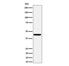 Western blot testing of human SH-SY5Y cell lysate with NODAL antibody. Predicted molecular weight ~4
