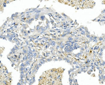 EDNRA Antibody / Endothelin A Receptor