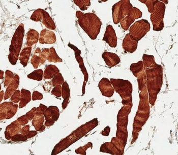 IHC testing of FFPE human skeletal muscle tissue with MCT4 antibody. HIER: steam section in pH6 citr