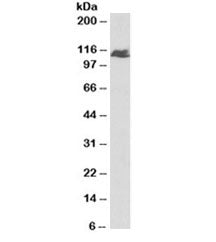 Western blot testing of human liver lysate with BMPR2 antibody at 1ug/ml. Predicted molecular weight