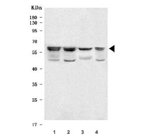ACAD9 Antibody