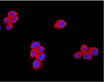 Immunofluorescent staining of FFPE human MCF7 cells with TRPM7 antibody (red) and DAPI nuclear stain