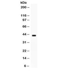 Western blot testing of human MCF7 cell lysate with Sp5 antibody. Expected/observed molecular weight