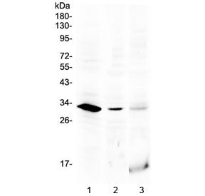 Western blot testing of 1) rat testis, 2) mouse testis and 3) human MCF7 lysate with HOXB1 antibody 