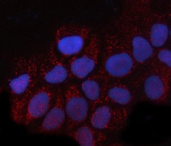 Immunofluorescent staining of FFPE human A431 cells with GNB1 antibody (red) and DAPI nuclear stain 