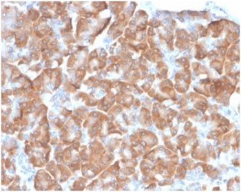 40S Ribosomal protein SA Antibody / RPSA / Laminin Receptor 1