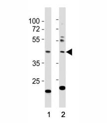 Western blot testing of E2F1 antibody at 1:1000 dilution. Lane 1: NIH3T3 lysate; 2: A431; Predicted 