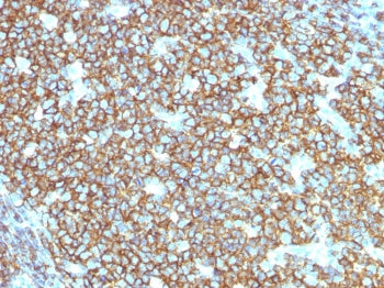 IHC testing of FFPE human tonsil tissue with recombinant CD20 antibody (clone rIGEL/773). Required H