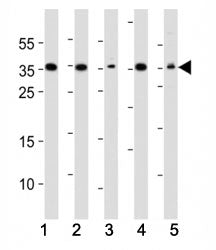 DKK1 Antibody