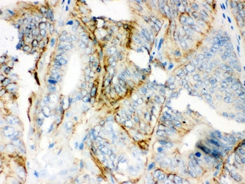 PKLR Antibody