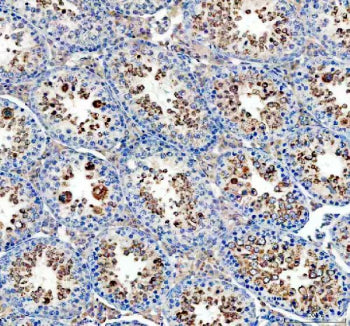 GPX4 Antibody / Glutathione Peroxidase 4, 100ug