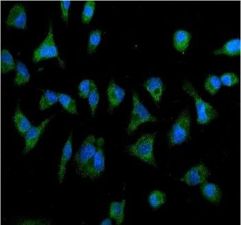 Immunofluorescent staining of FFPE human A549 cells with IL2RB antibody (green) and DAPI nuclear sta