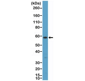 Western blot testing of human A431 cell lysate with recombinant Cytokeratin 10 antibody at 1:200 dil