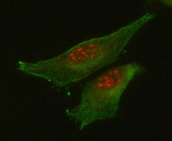 RETREG1 Antibody / FAM134B / JK-1